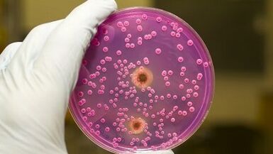 Pathological discharge to men when excited